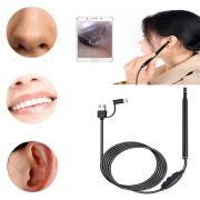 Wifi visual ear endoscope