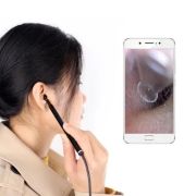 Wifi visual ear endoscope